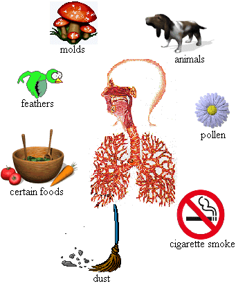 Allergic asthma treatment and symptoms