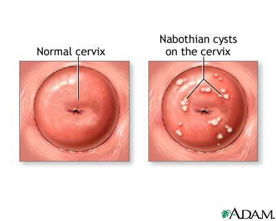 Cervix - what is