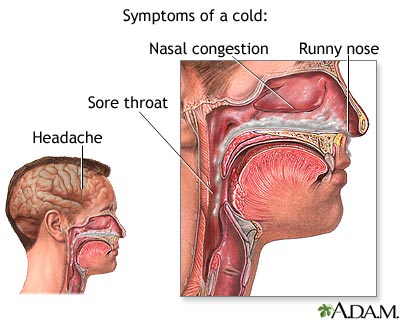 Colds symptoms and treatment