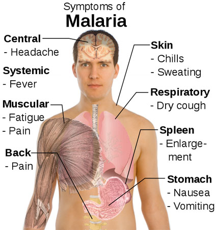 Malaria - symptoms and treatment
