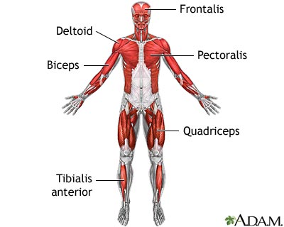 Polymyositis - symptoms, treatment, and prognosis