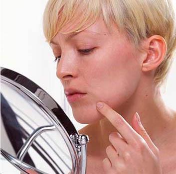 Acne - treatment, medication and removal