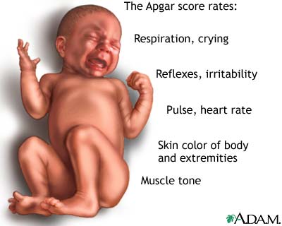 Apgar score definition