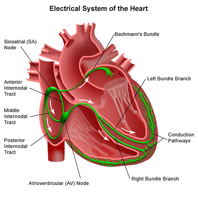 Arrhythmia Heart - definition, symptoms and treatment