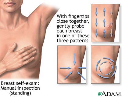 Breast self-examination and cancer