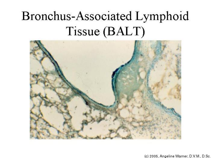 BALT - bronchus-associated lymphoid tissue