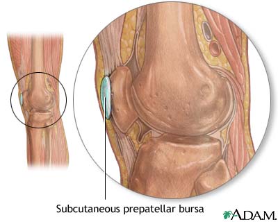 Bursa What is and Definition