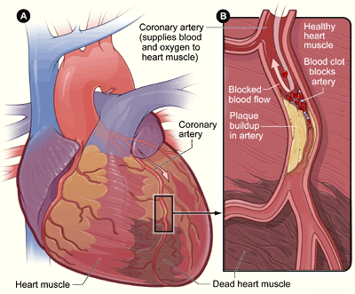 Cardiac Enzymes - definition