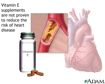 Cardiovascular Disease (CVD) - what is, definition, causes and risk factors