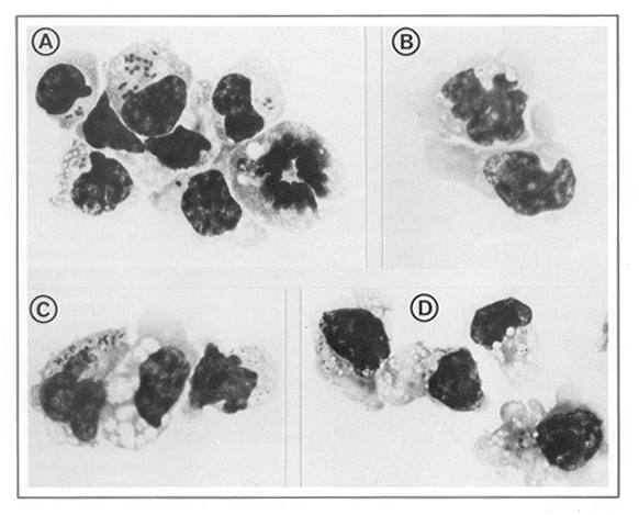 Carrier and bacterial or viral infection