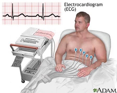 Electrocardiogram (ECG) diagnostic procedure