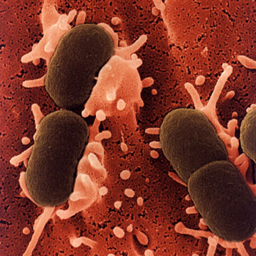 Escherichia (E) coli infection and symptoms
