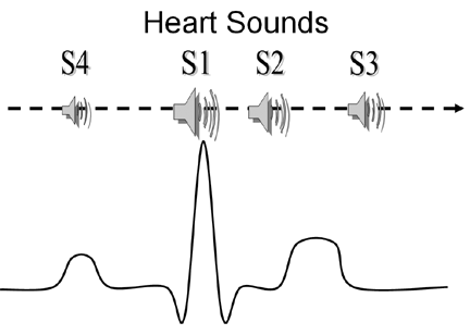 Heart Sounds definition