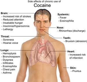 Hypoxia definition and symptoms