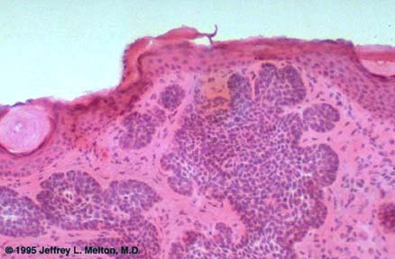 Keratinocyte - human cell - function