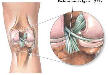 Knee injuries