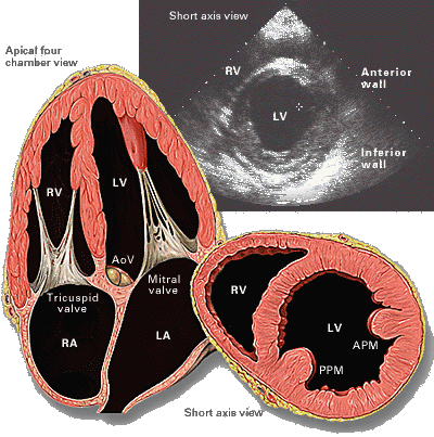Left ventricular ejection fraction (LVEF)