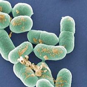 Listeriosis and Bacteria Listeria - symptoms and treatment