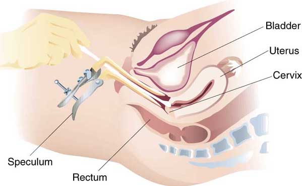 Pelvic Examination procedure