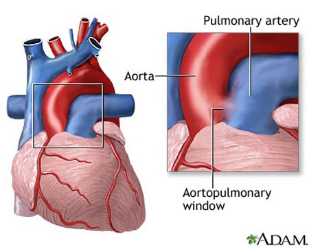 Pulmonary Arteries - function and definition