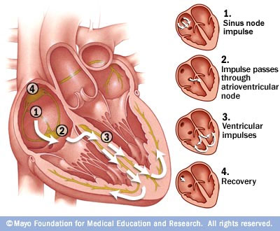 Sick Sinus Syndrome - Symptoms and Treatment