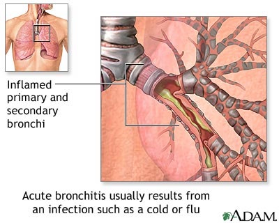 Tachypnea definition