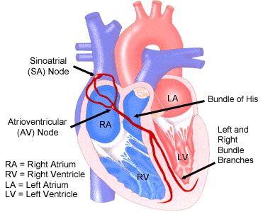Bundle Branch Block - left / right and ECG (EKG)